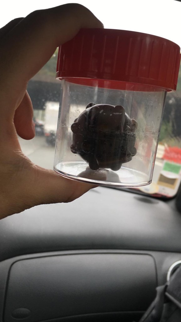 Un flacon-pot médical transparent tenu dans le creux d’une paume. À l’intérieur du pot on voit une balle à picots de couleur sombre.